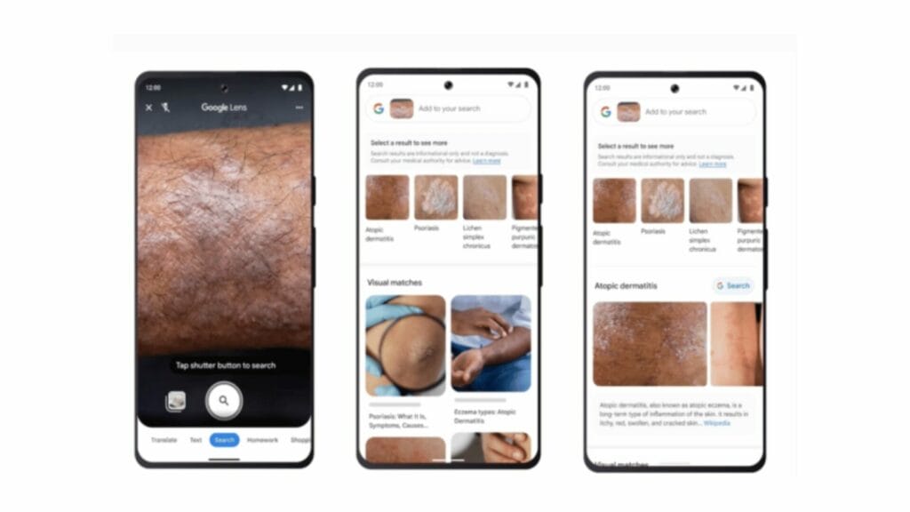 google lens skin conditions google lens skin conditions